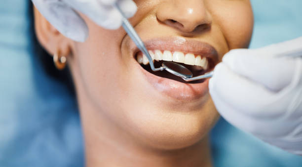 Best Emergency Dentist for Knocked-Out Tooth in Holtville, CA